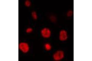 ABIN6274328 staining HepG2 cells by IF/ICC. (ELAVL2 抗体  (N-Term))