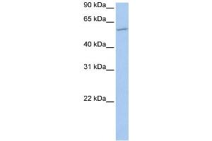 Western Blotting (WB) image for anti-Membrane Bound O-Acyltransferase Domain Containing 1 (MBOAT1) antibody (ABIN2459208) (MBOAT1 抗体)