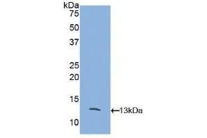 Detection of Recombinant MCP2, Mouse using Polyclonal Antibody to Monocyte Chemotactic Protein 2 (MCP2) (CCL8 抗体  (AA 20-94))