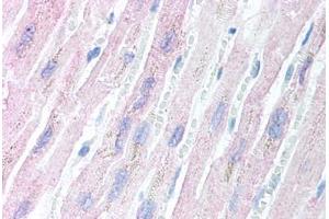 Human Heart (formalin-fixed, paraffin-embedded) stained with AES antibody ABIN213897 at 5 ug/ml followed by biotinylated goat anti-rabbit IgG secondary antibody ABIN481713, alkaline phosphatase-streptavidin and chromogen. (AES 抗体  (N-Term))