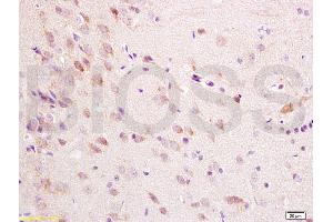 Formalin-fixed and paraffin embedded rat brain tissue labeled with Anti-ChRM1/Acetylcholine receptor(M1) Polyclonal Antibody, Unconjugated (ABIN738396) at 1:200 followed by conjugation to the secondary antibody, (SP-0023), and DAB staining (CHRM1 抗体  (AA 321-420))