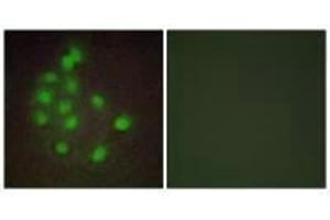 Immunofluorescence analysis of A549 cells, using HAND1 antibody. (HAND1 抗体)
