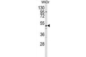 Western Blotting (WB) image for anti-Aldehyde Dehydrogenase 5 Family, Member A1 (ALDH5A1) antibody (ABIN2998190)