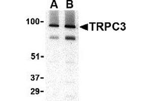 Western Blotting (WB) image for anti-Transient Receptor Potential Cation Channel, Subfamily C, Member 3 (TRPC3) (C-Term) antibody (ABIN1030778) (TRPC3 抗体  (C-Term))