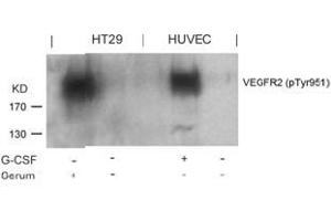Image no. 2 for anti-VEGF Receptor 2 (VEGFR2) (pTyr951) antibody (ABIN196770) (VEGFR2/CD309 抗体  (pTyr951))