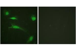 Immunofluorescence analysis of HeLa cells, using p53 (Ab-20) Antibody. (p53 抗体  (AA 10-59))