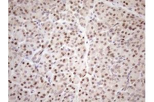 Immunohistochemistry (IHC) image for anti-Achalasia, Adrenocortical Insufficiency, Alacrimia (AAAS) (AA 322-546) antibody (ABIN2715861)