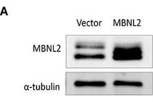 Western Blotting (WB) image for anti-Tubulin, alpha 1B (TUBA1B) antibody (ABIN2855283)
