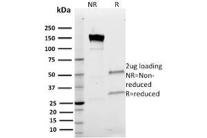 SDS-PAGE Analysis Purified Band III Mouse Monoclonal Antibody (Q1/156). (Band 3/AE1 抗体)