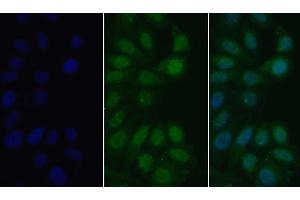 Detection of MyD88 in Human HepG2 cell using Polyclonal Antibody to Myeloid Differentiation Factor 88 (MyD88) (MYD88 抗体  (AA 32-265))