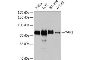 Western blot analysis of extracts of various cell lines using YAP1 Polyclonal Antibody at dilution of 1:1000. (YAP1 抗体)