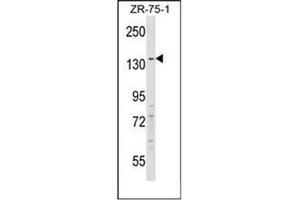 Western blot analysis of RFX1 Antibody (C-term) in ZR-75-1 cell line lysates (35ug/lane). (RFX1 抗体  (C-Term))