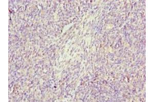 Immunohistochemistry of paraffin-embedded human thymus tissue using ABIN7154419 at dilution of 1:100 (GZMH 抗体  (AA 20-246))
