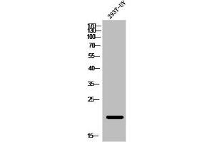 Western Blot analysis of 293T-UV cells using ATF-3 Polyclonal Antibody (ATF3 抗体  (C-Term))
