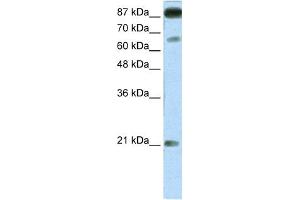 WB Suggested Anti-NFATC4 Antibody Titration:  1. (NFATC4 抗体  (Middle Region))