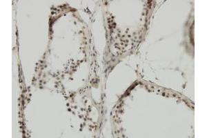 Image no. 5 for anti-Tripartite Motif Containing 24 (TRIM24) (AA 432-569) antibody (ABIN599067) (TRIM24 抗体  (AA 432-569))