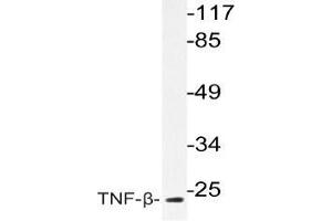 Western blot (WB) analysis of TNF-beta antibody in extracts from COS-7cells. (LTA 抗体)