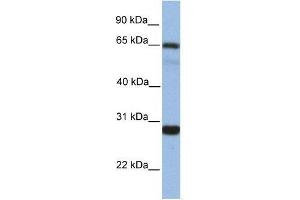 Western Blot showing MED4 antibody used at a concentration of 1. (MED4 抗体  (Middle Region))