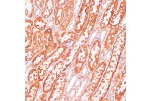 Immunohistochemistry of paraffin-embedded mouse kidney using Caspase-9 antibody (ABIN3016349, ABIN3016350, ABIN3016351 and ABIN6219728) at dilution of 1:100 (40x lens). (Caspase 9 抗体)