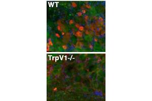 Immunofluorescence staining of adult dorsal root ganglion sections from TrpV1 WT and -/- mice with N221/17 TC supe (red), Kv1.