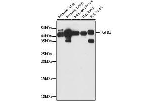 Western blot analysis of extracts of various cell lines, using TGFB2 antibody (ABIN1683015, ABIN3017925, ABIN3017926 and ABIN6220307) at 1:1000 dilution. (TGFB2 抗体  (AA 20-160))