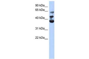 NSUN3 antibody used at 1 ug/ml to detect target protein. (NSUN3 抗体  (Middle Region))