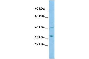 Host: Rabbit Target Name: ABHD14A Sample Type: 293T Whole Cell lysates Antibody Dilution: 1. (ABHD14A 抗体  (C-Term))