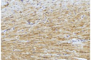 ABIN6277424 at 1/100 staining Mouse muscle tissue by IHC-P. (PDK4 抗体  (C-Term))