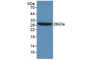 Detection of Recombinant Gelsolin, Human using Monoclonal Antibody to Gelsolin (GSN) (Gelsolin 抗体  (AA 432-553))