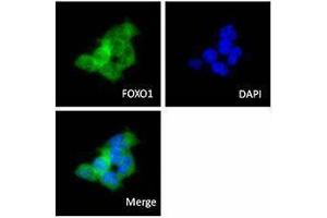 Immunofluorescence (IF) image for anti-Forkhead Box O1 (FOXO1) antibody (ABIN2664978) (FOXO1 抗体)