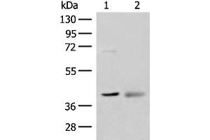 Western blot analysis of Mouse kidney tissue and Human fetal brain tissue lysates using ADH5 Polyclonal Antibody at dilution of 1:500 (ADH5 抗体)