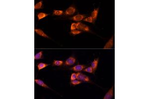 Immunofluorescence (IF) image for anti-Thioredoxin Domain Containing 12 (Endoplasmic Reticulum) (TXNDC12) (AA 93-172) antibody (ABIN7270800)