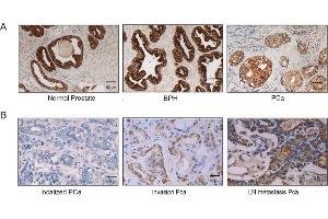 Immunostaining of XPNPEP2 expression in human prostate tissue. (XPNPEP2 抗体  (Center))