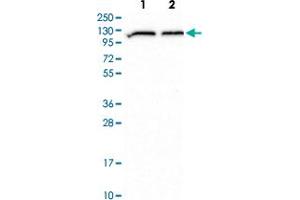Western blot analysis of Lane 1: Human cell line RT-4 Lane 2: Human cell line U-251MG with ADAR polyclonal antibody  at 1:500-1:1000 dilution. (ADAR 抗体)