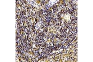 Immunohistochemical analysis of CD238 staining in human spleen formalin fixed paraffin embedded tissue section. (KEL 抗体)