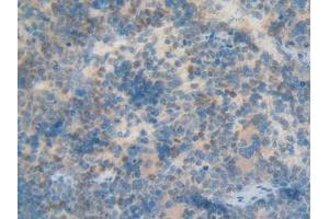 Used in DAB staining on fromalin fixed paraffin- embedded kidney tissue (KRT12 抗体  (AA 398-456))