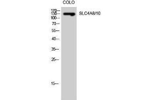 Western Blotting (WB) image for anti-Solute Carrier Family 4, Member 8/10 (SLC4A8/10) (Internal Region) antibody (ABIN3186974) (SLC4A8/10 抗体  (Internal Region))
