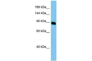 WB Suggested Anti-Ap1g1 Antibody Titration: 1. (gamma 1 Adaptin 抗体  (Middle Region))