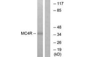 Western Blotting (WB) image for anti-Melanocortin 4 Receptor (MC4R) (AA 281-330) antibody (ABIN2890891) (MC4R 抗体  (AA 281-330))