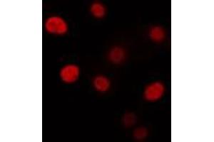 ABIN6274332 staining Hela cells by IF/ICC. (CHAF1B 抗体  (N-Term))