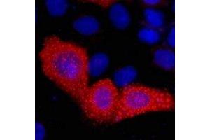 Immunofluorescent analysis of VSV-G-tag staining in 293T cells transfected with a VSV-G-tag protein. (VSV-g Tag 抗体)