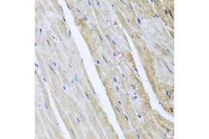 Immunohistochemistry of paraffin-embedded mouse heart using CAMK2G antibody at dilution of 1:100 (x40 lens). (CAMKII gamma 抗体)