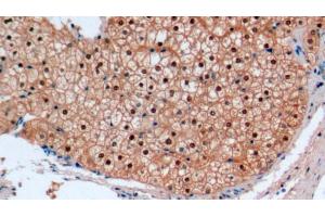 Detection of ARG in Human Liver Tissue using Monoclonal Antibody to Arginase (ARG) (ARG 抗体  (AA 1-322))