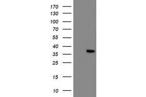 HEK293T cells were transfected with the pCMV6-ENTRY control (Left lane) or pCMV6-ENTRY NRIP3 (Right lane) cDNA for 48 hrs and lysed. (NRIP3 抗体)