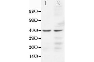 Western Blotting (WB) image for anti-Chemokine (C-C Motif) Receptor 5 (CCR5) (AA 19-34), (N-Term) antibody (ABIN3044318)