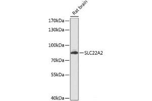 Western blot analysis of extracts of Rat brain using SLC22A2 Polyclonal Antibody at dilution of 1:1000. (SLC22A2 抗体)