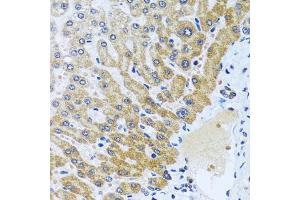 Immunohistochemistry of paraffin-embedded human liver using CP antibody (ABIN6129673, ABIN6138930, ABIN6138932 and ABIN6217722) at dilution of 1:100 (40x lens). (CPA6 抗体  (AA 130-437))