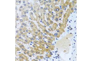 Immunohistochemistry of paraffin-embedded human liver using CP antibody (ABIN6129673, ABIN6138930, ABIN6138932 and ABIN6217722) at dilution of 1:100 (40x lens). (CPA6 抗体  (AA 130-437))