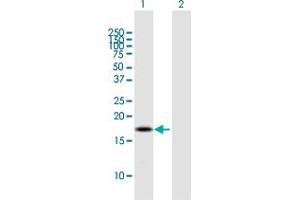 Western Blot analysis of BOLA2B expression in transfected 293T cell line by BOLA2B MaxPab polyclonal antibody. (BOLA2B 抗体  (AA 1-152))