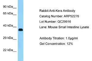 Western Blotting (WB) image for anti-Keratocan (KERA) (C-Term) antibody (ABIN2784856) (KERA 抗体  (C-Term))